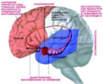 Участки мозга человека, отвечающие за различные виды забывчивости