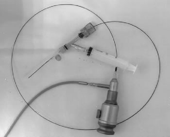 Гибкий эндоскоп диаметром 0,56 мм (1,7 Fr), У-образный вазограф с двухконечным соединением, и полая игла с калибром канюли - 18